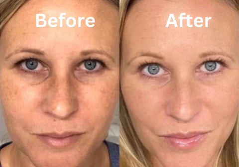 Skuggor Lift & Sculpt - EMS Microcurrent Massager