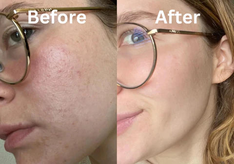 Skuggor Lift & Sculpt - EMS Microcurrent Massager