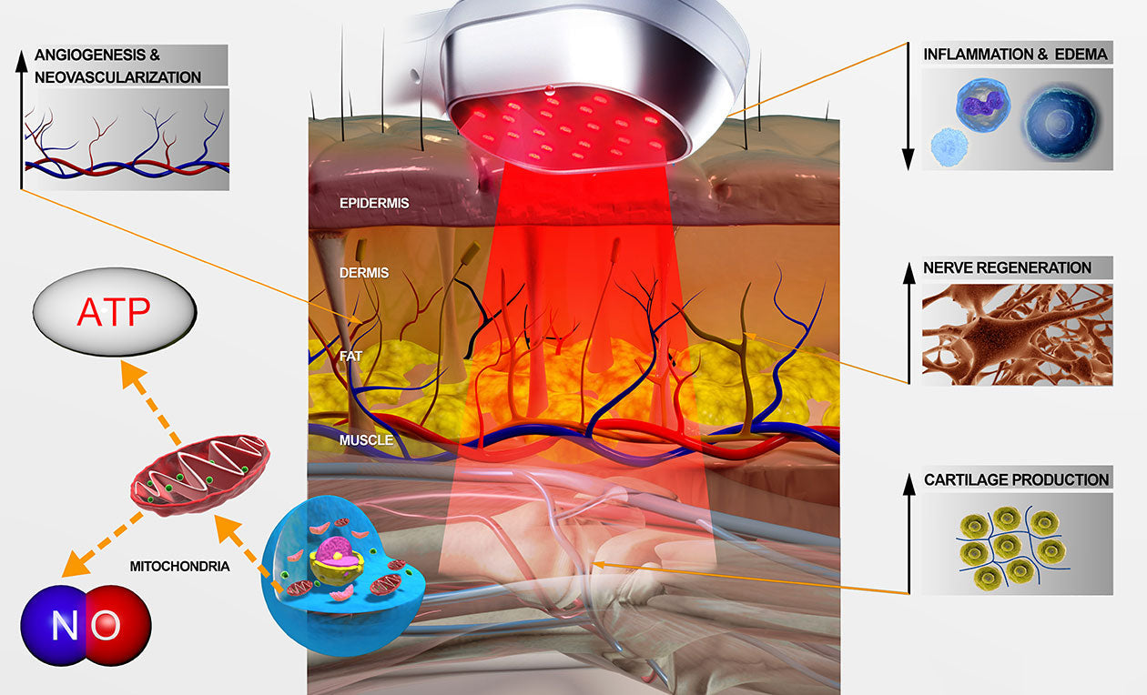 Skuggor LumaPulse Upgraded Cold Laser Red Light Therapy Device