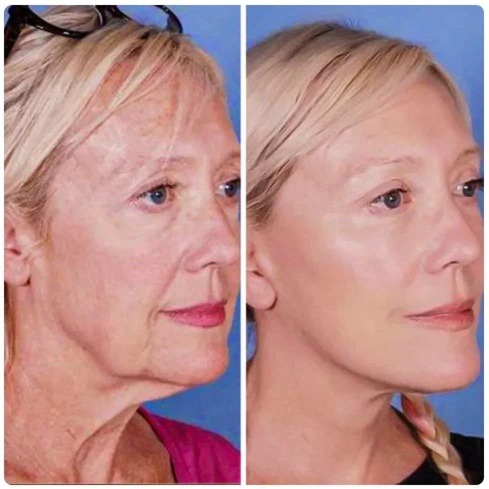 Skuggor Lift & Sculpt - EMS Microcurrent Massager